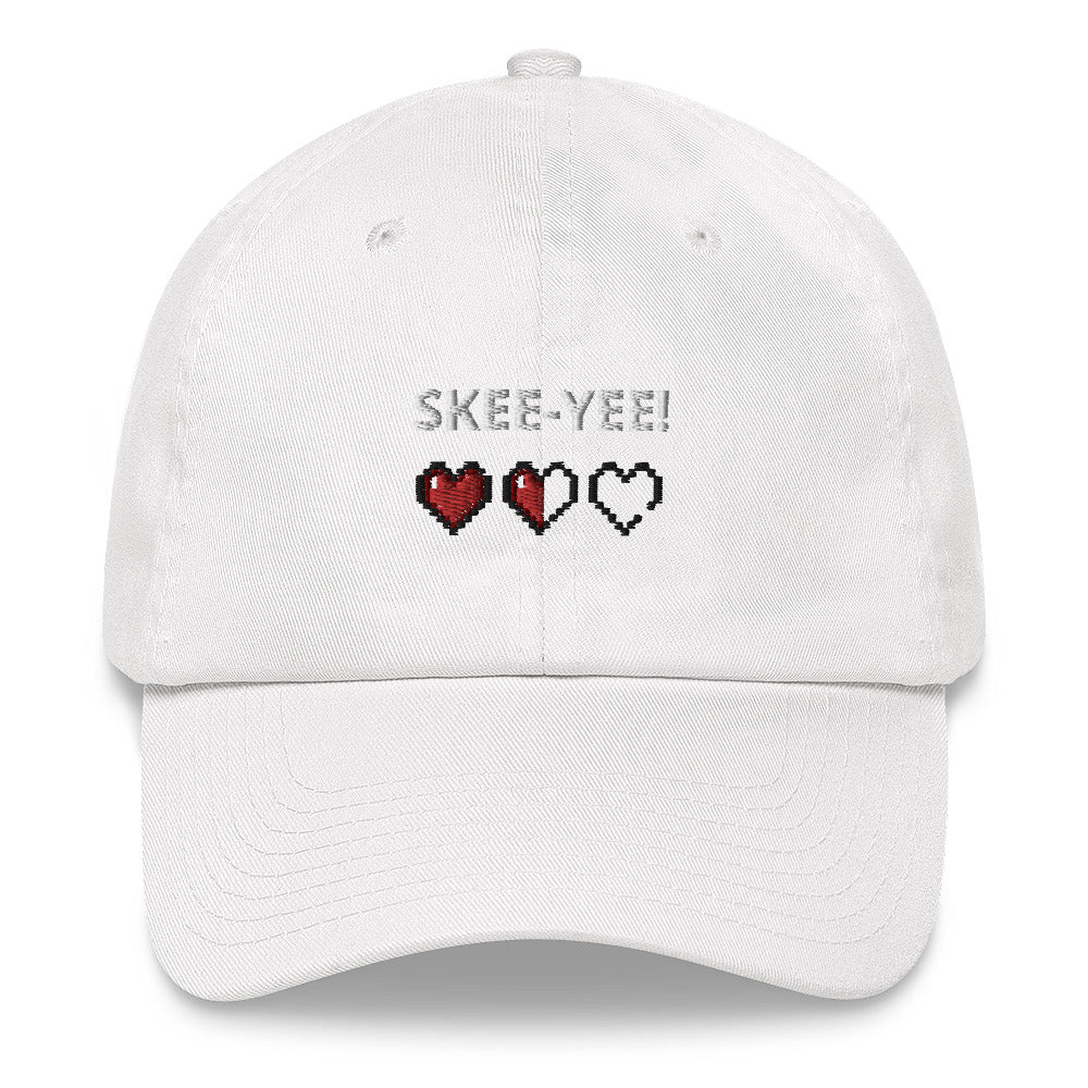 SkeeYee